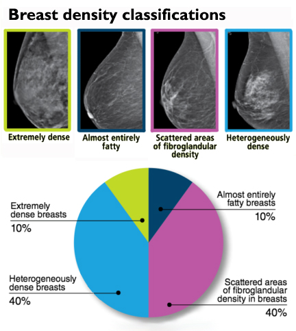 graphic describing breast densities