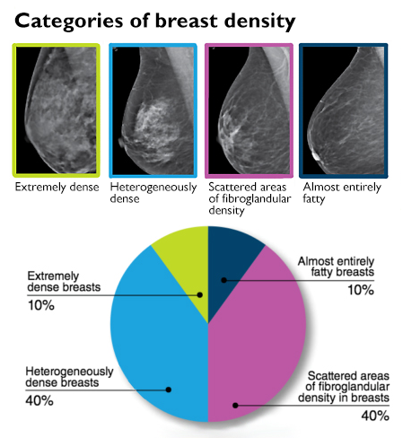 chart listing breast-density categories