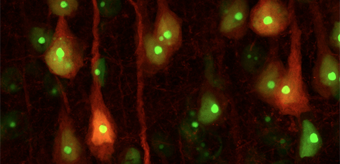 picture of individual brain cell nuclei