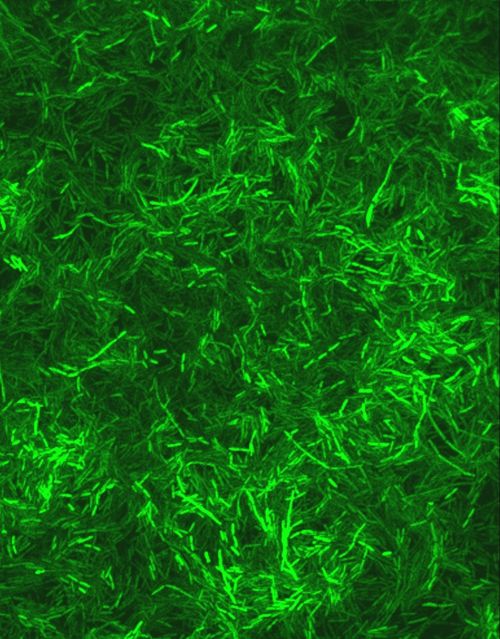 Pseudomonas bacteria with a green fluoresent dye.