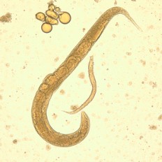 S. stercoralis