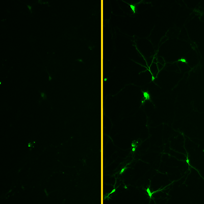 contrasting laboratory images of rat neuronal activity