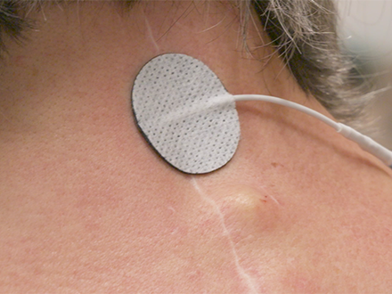 picture of patch over spinal stimulation device