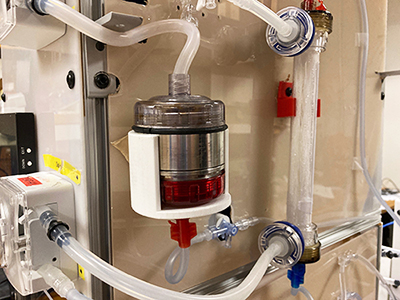 picture of machine section that removes albumin toxins from blood