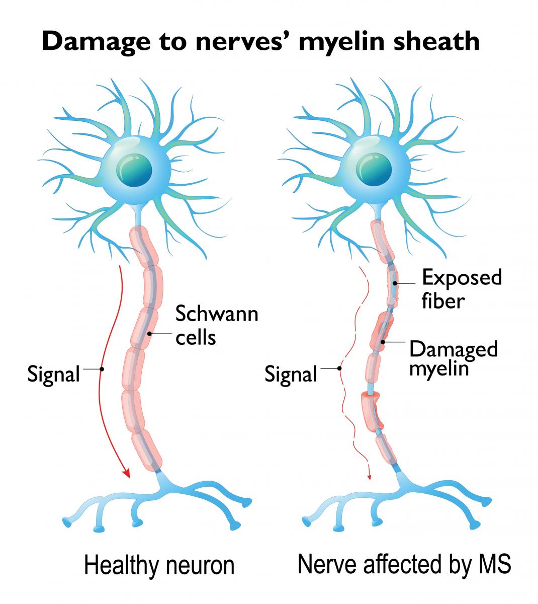 illustration of neurons