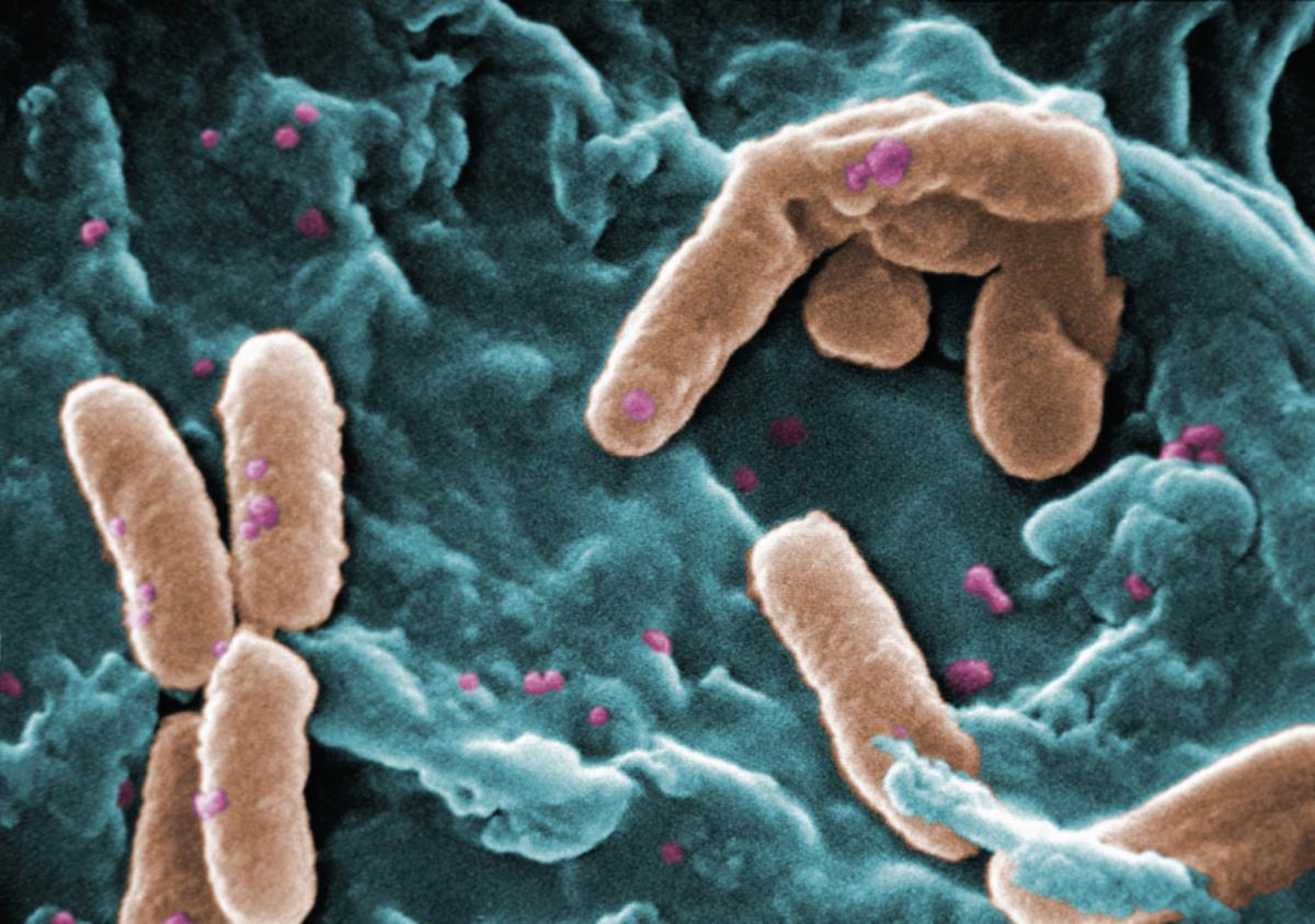 Scanning elecron microscope image of Pseudomonas