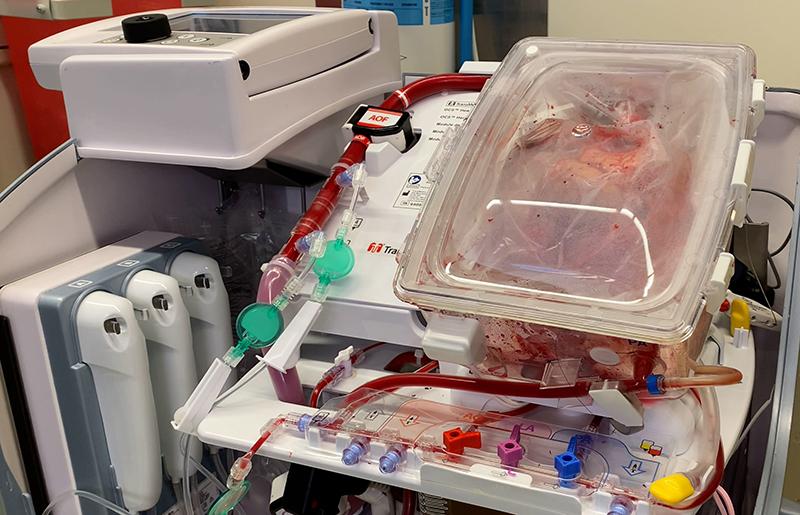 picture of circulatory machine used to transport donor heart for transplantation