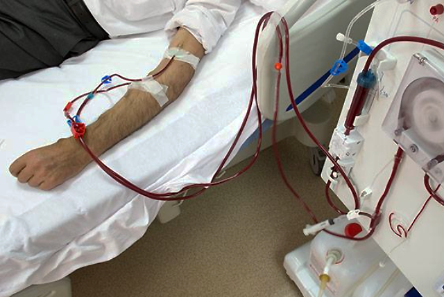 picture of a man's arm connected to hemodialysis