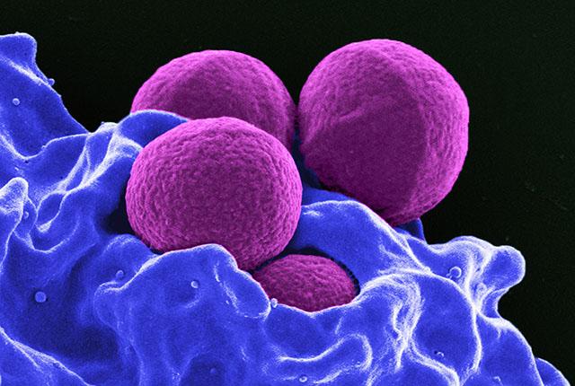 Dyed purple staph bacteria attacked by blue white blood cells. 