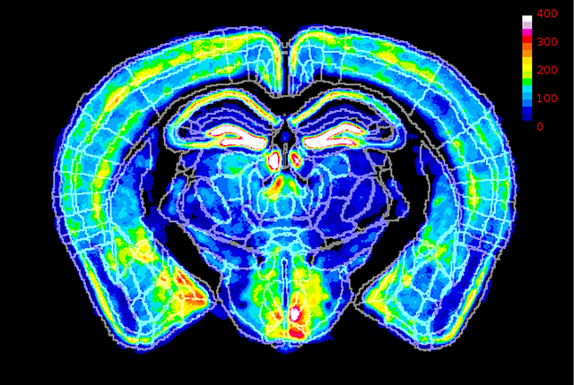 image of X chromosome inactivation varies across different areas of brains