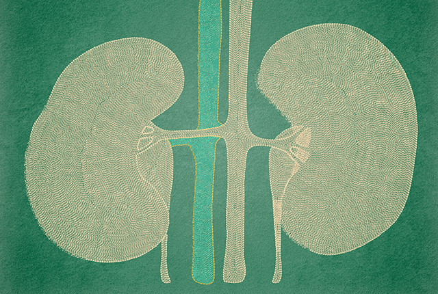 Study crystallizes distinct kidney benefits of common drug - UW Medicine |  Newsroom