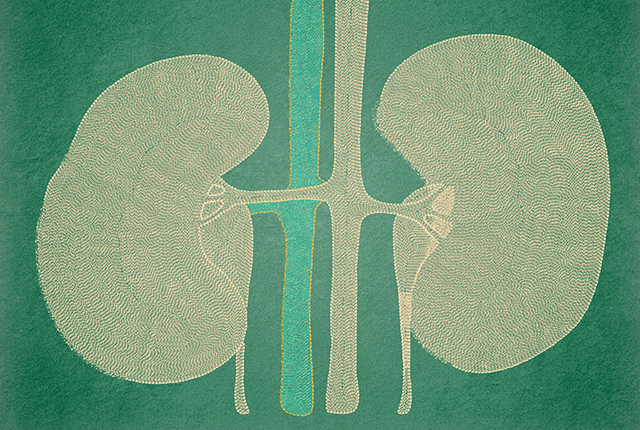 Study crystallizes distinct kidney benefits of common drug – UW Medicine | Newsroom