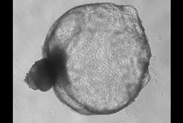 This is the image for Investigator’s tiny kidney systems gain a national stage entry