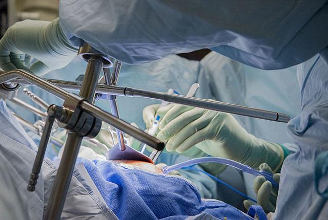 detail photo of a surgeon's hands in the operating room