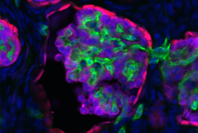 microscopic picture of kidney tissue containing human filtering cells