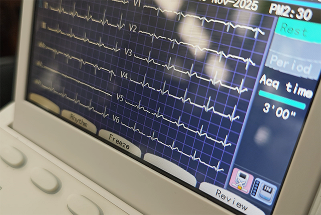 a patient's EKG readout is displayed on a monitor
