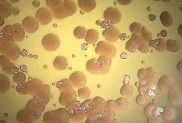 Pseudomonas aeruginosa bacterial colonies from a person with cystic fibrosis growing on agar plates