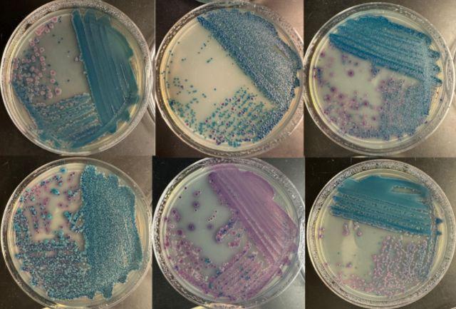 Four-quadrant streaking of fecal samples on chromogenic UTI agar shows various patterns of relative bacterial species abundance. The assorted shapes of the pinkish colonies indicate different E. coli strains.