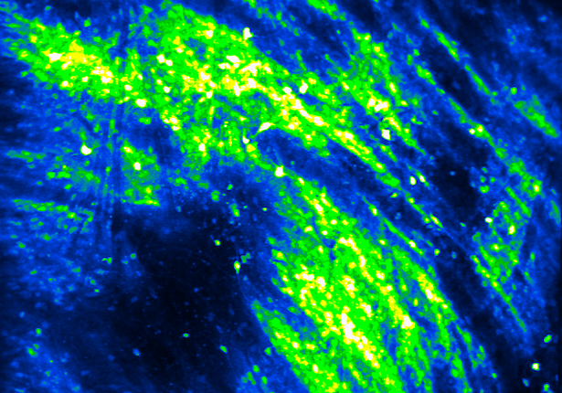 Deep-brain imaging shows neural activity during motivated behavior.