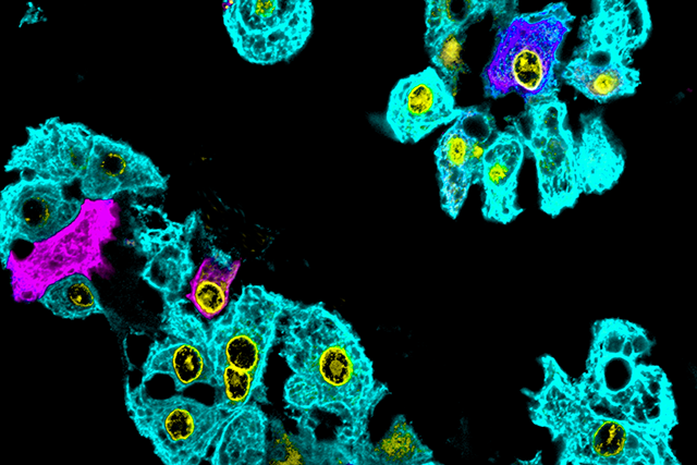 Media Name: allen_image2_kelly_stevens_lab.png