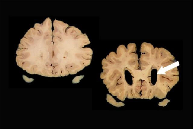 Media Name: brain_images_for_paul_crane_paper.jpg