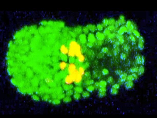 Media Name: c_elegans_roundworm.jpg