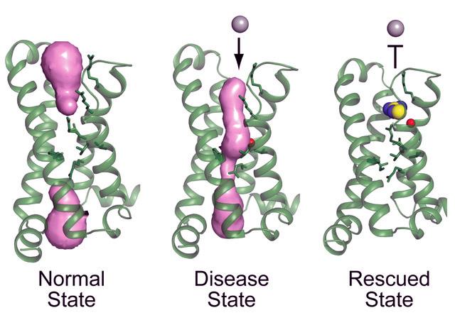 Media Name: catterall_paralysis_ion_channel.jpg