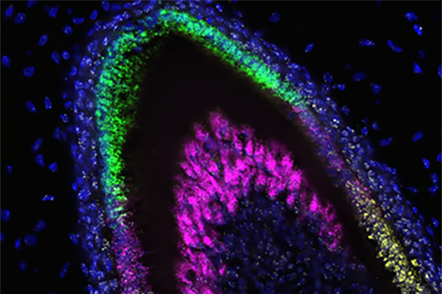 Media Name: dental_organoids2.png