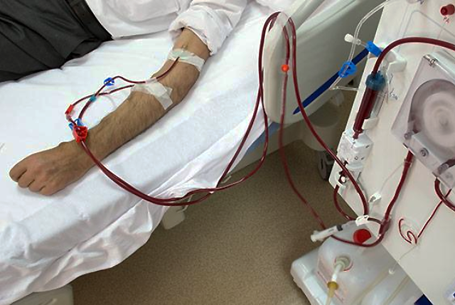 Media Name: dialysis-main.png