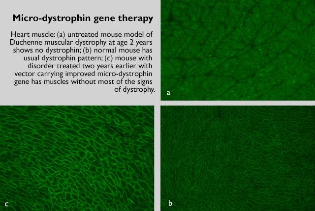 Media Name: dystrophin_therapy_final.jpg