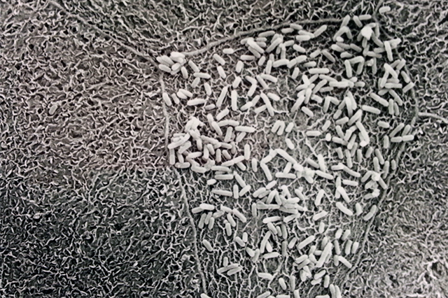 Media Name: e._coli_on_bladder_cell.png