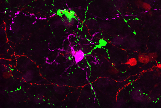 Media Name: eye_neurons.png