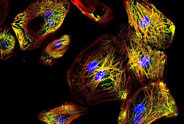 Media Name: heart_muscle_cells_murry_iscrm_cropped.jpg