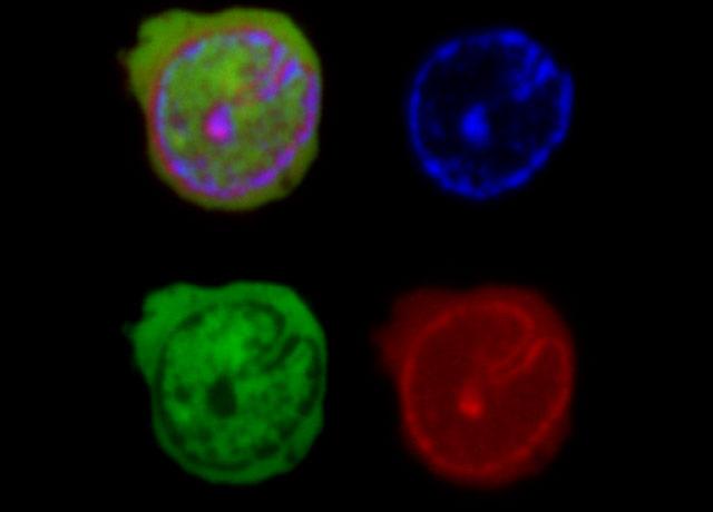 Media Name: high_res_daunorubicin_aml221.jpg