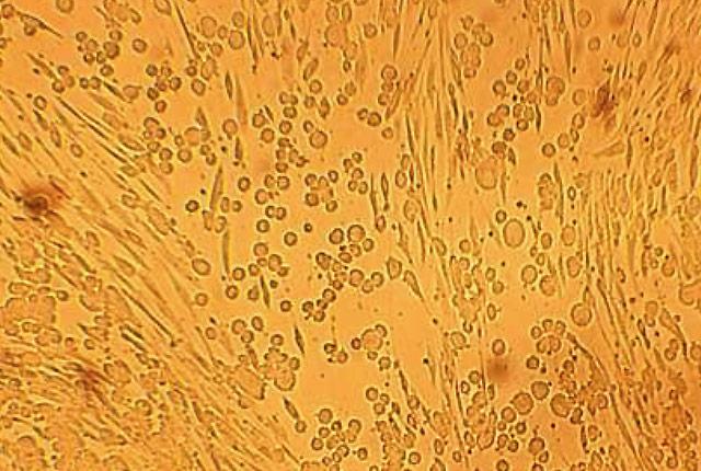 Media Name: hsv_in_culture_image.jpg