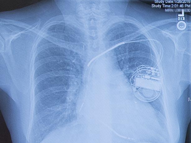 Media Name: icd.jpg