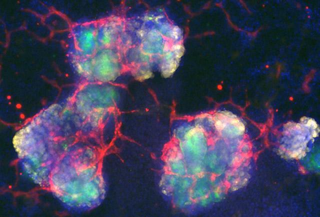Media Name: kidney_organoids_with_blood_vessel_network_freedman_cropped.jpg
