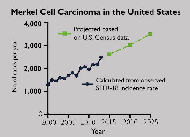 Media Name: merkel_cell_chart.jpg