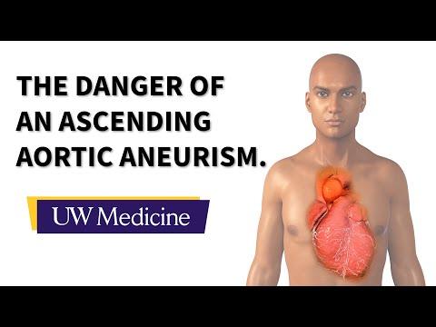 This is the image for Aortic aneurysm blamed in soccer reporter’s death video