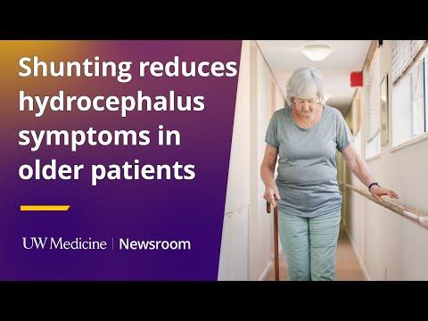 This is the image for Shunting improves hydrocephalus symptoms in older adults video