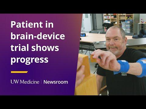 This is the image for  Patient in brain-device trial shows progress video