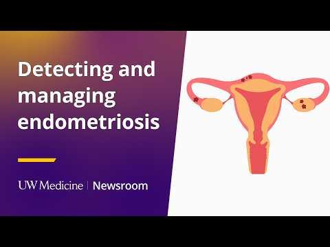 This is the image for Detecting and managing endometriosis  video