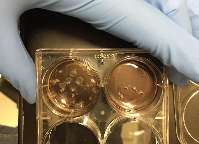 Media Name: pkd_organoids_left_versus_control_right_cropped.jpg