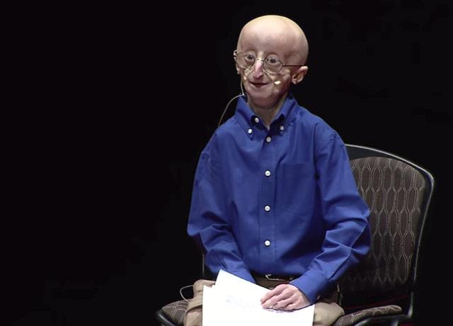 Media Name: progeria.jpg