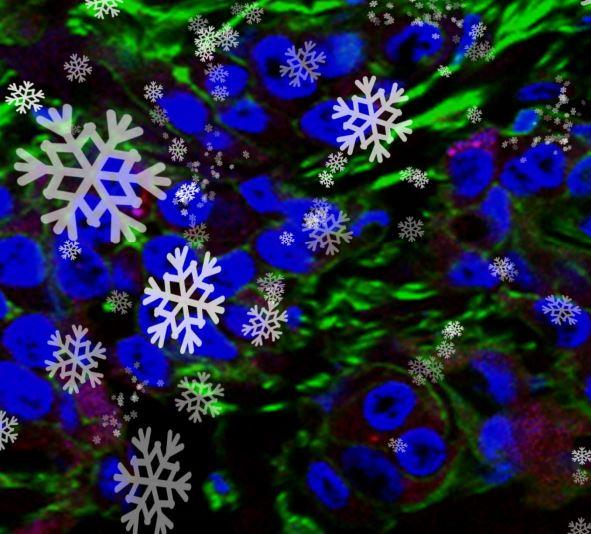 This is the image for New technique adheres cancer-fighting agents to prostate tumors entry