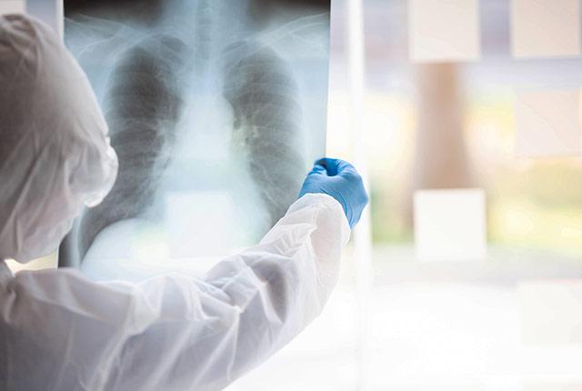 Media Name: raghu-lung_commentary-covid.jpg