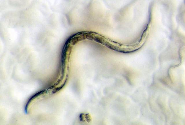 Media Name: roundworm_c._elgans_adjusted_marie-anne_felix_monod_institute_nsf_copy.jpg