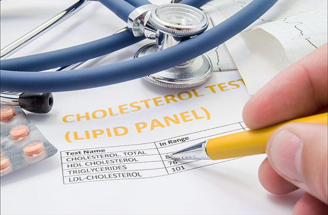 Cardiologist Weighs Statins Risks Benefits Uw Medicine Newsroom