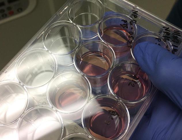 Media Name: stem_cell_cultures_jessica_young_cropped.jpg