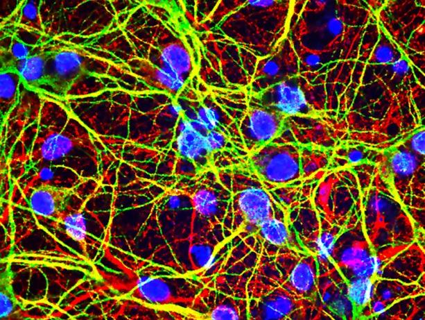 Media Name: westnile.jpg